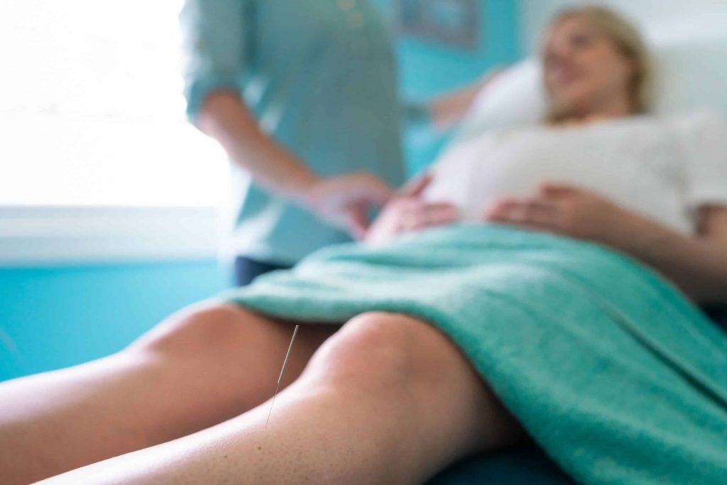 Stress acupuncture